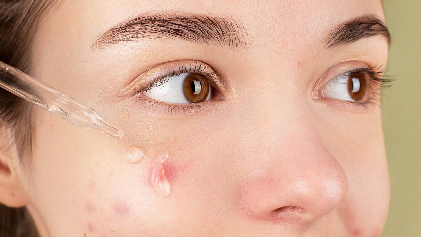 Tratamiento facial anti acné con mascarilla purificante